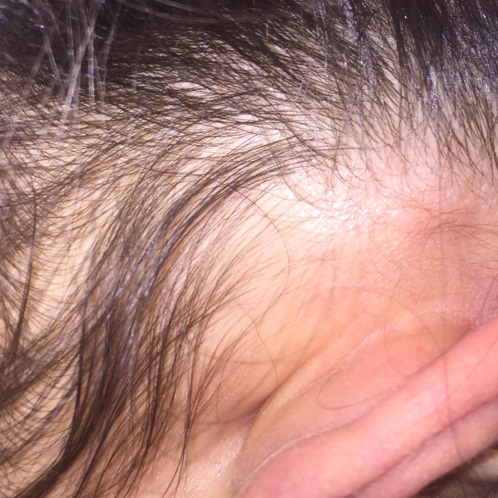 Hinter dem Ohr Beule? (Kopf)