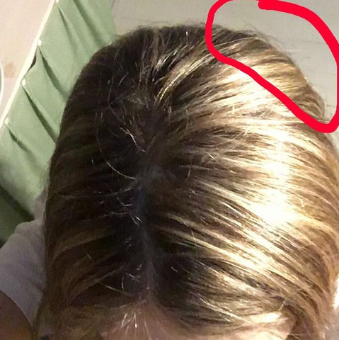 Hintere Kopfschmerzen Rechts Hinten Hintere Kopfschmerzen Rechts Hinten