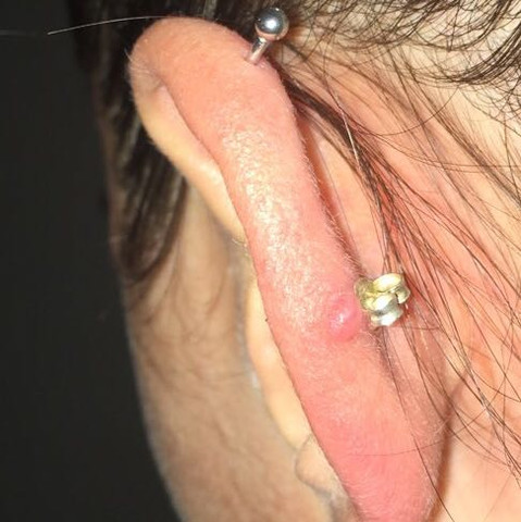 Mit Piercing  - (Gesundheit und Medizin, Piercing, Ohr)