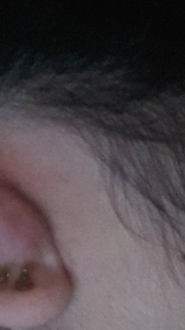 Hinterm ohr verhÀrtung Lymphknoten am