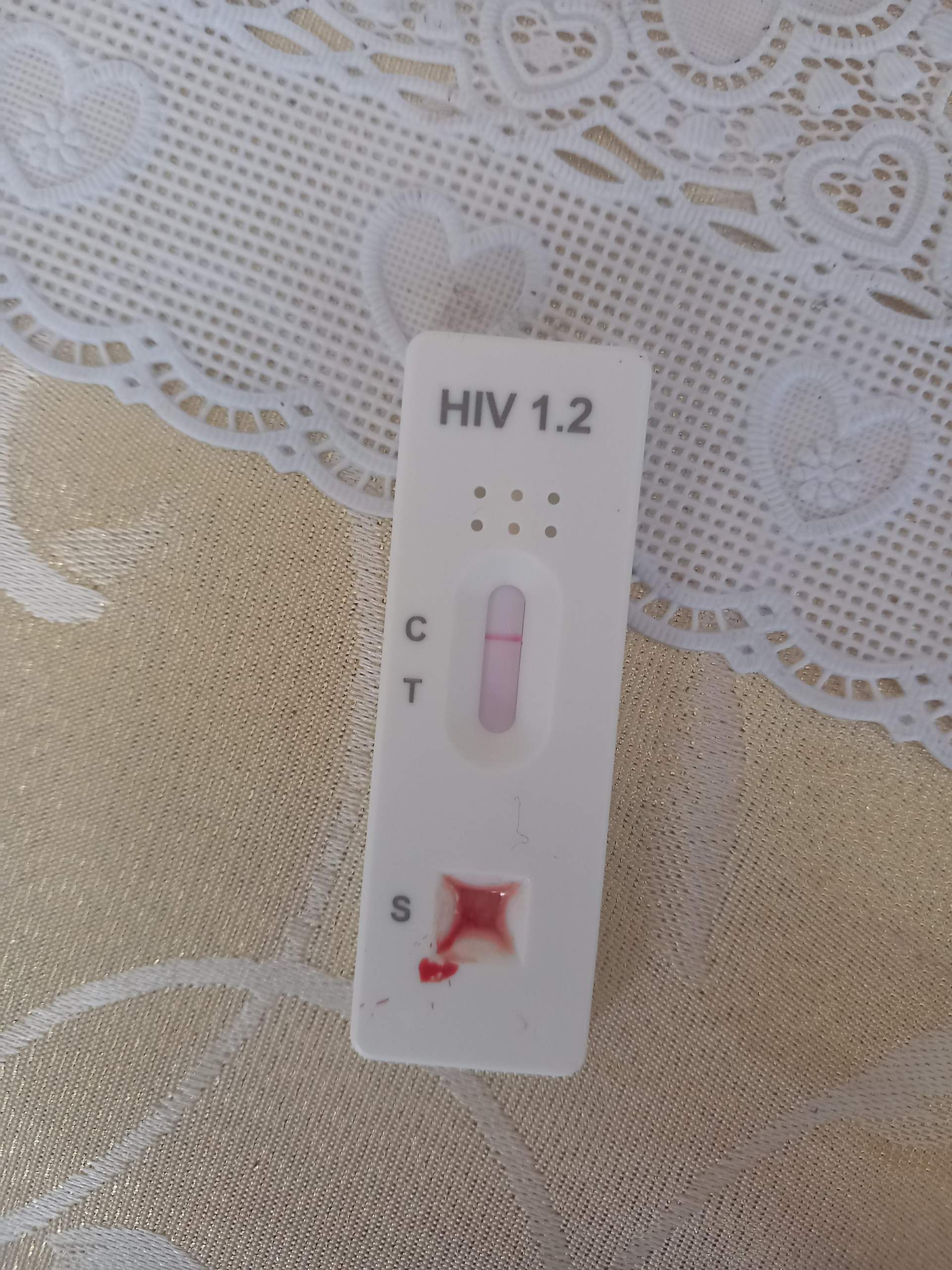 HIV Test gemacht? (HIV-Test)