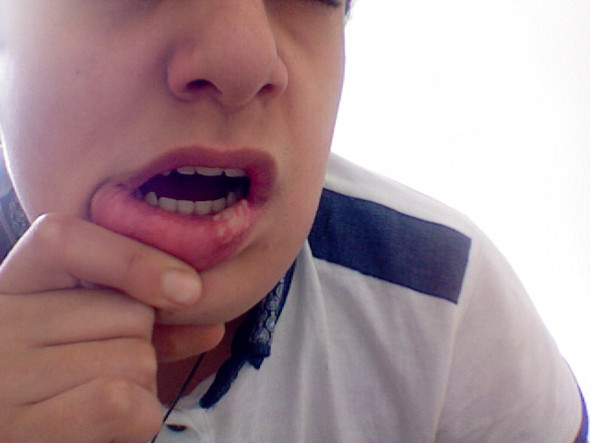 Hlfffe Meine Lippe Gesundheit Korper