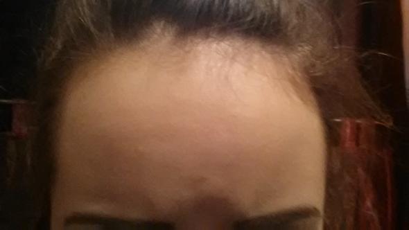 hohe stirn kaschieren und haaransatz