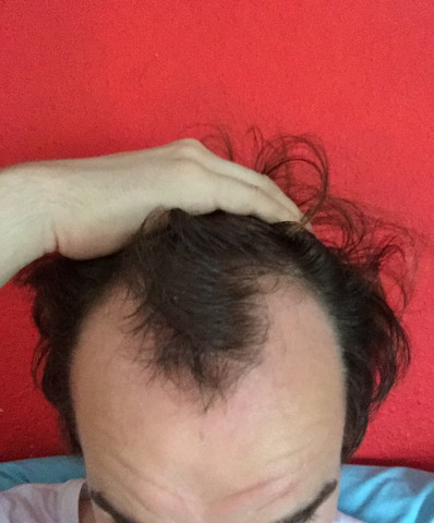 Bild 2 - (Haare, Männer, Frisur)