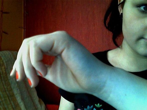 Hose Farbt Ab Hab Schon Vieles Probiert Waschen Flecken Hose Farbt Ab Hab Schon Vieles Probiert Waschen Flecken