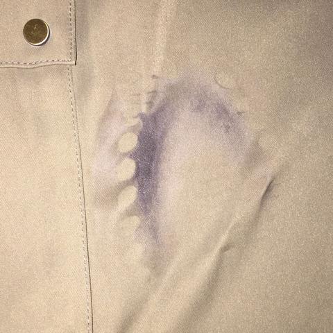 Hose Geschmolzen Kann Ich Sie Noch Retten Kleidung