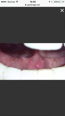 - (Medizin, Virus)