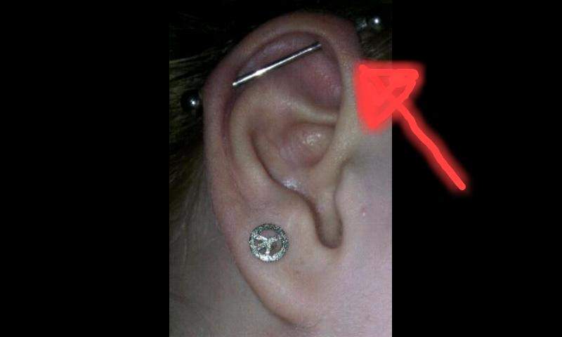 Gel entzündeten piercing bei tyrosur Kann man