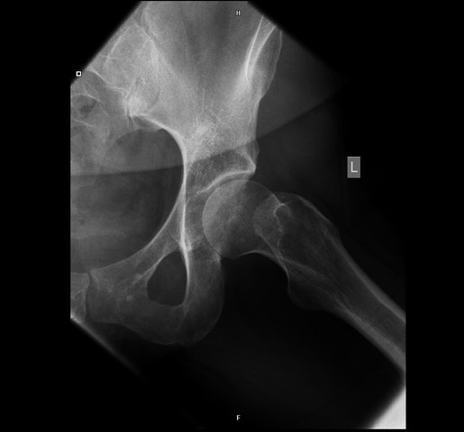 Ansicht 2 - (Orthopädie, Hüfte, Hüftgelenk)