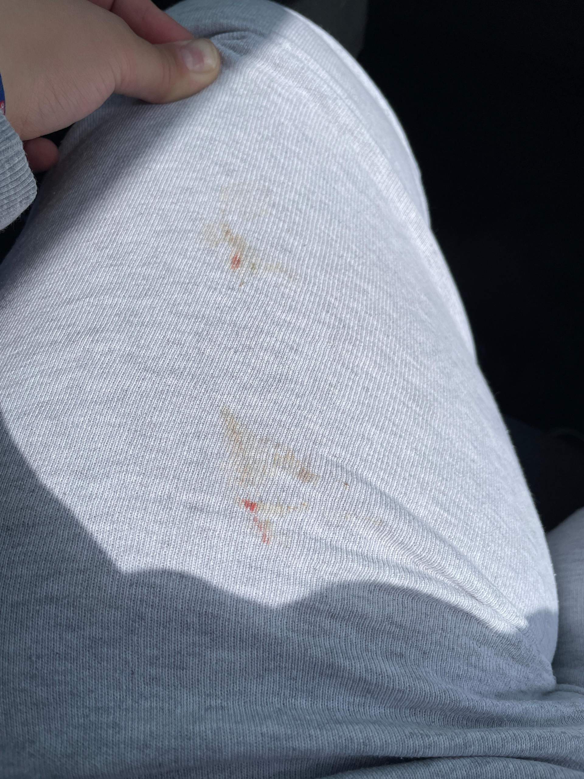 Hund blutet aus dem After? (Gesundheit, Blut, Tierarzt) Hund blutet aus dem After? (Gesundheit, Blut, Tierarzt)
