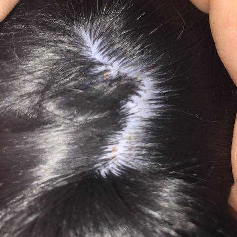 hund kratzt sich braune schuppen tiere zecken flohe