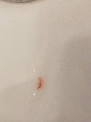 Husten Schleim Blut Gesundheit Und Medizin Hustensaft Husten Schleim Blut Gesundheit Und Medizin Hustensaft
