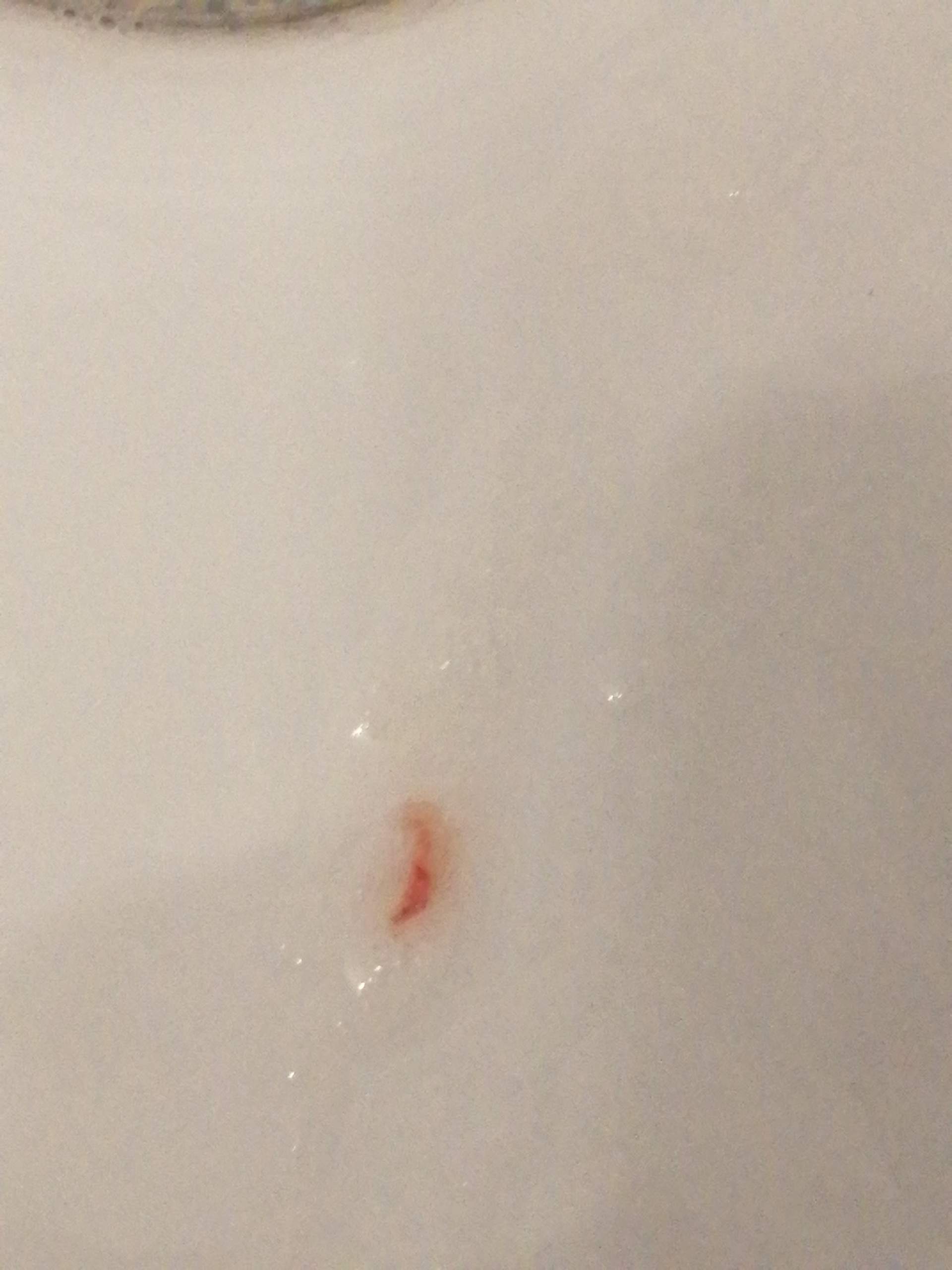 Husten Schleim Blut Gesundheit Und Medizin Hustensaft Husten Schleim Blut Gesundheit Und Medizin Hustensaft