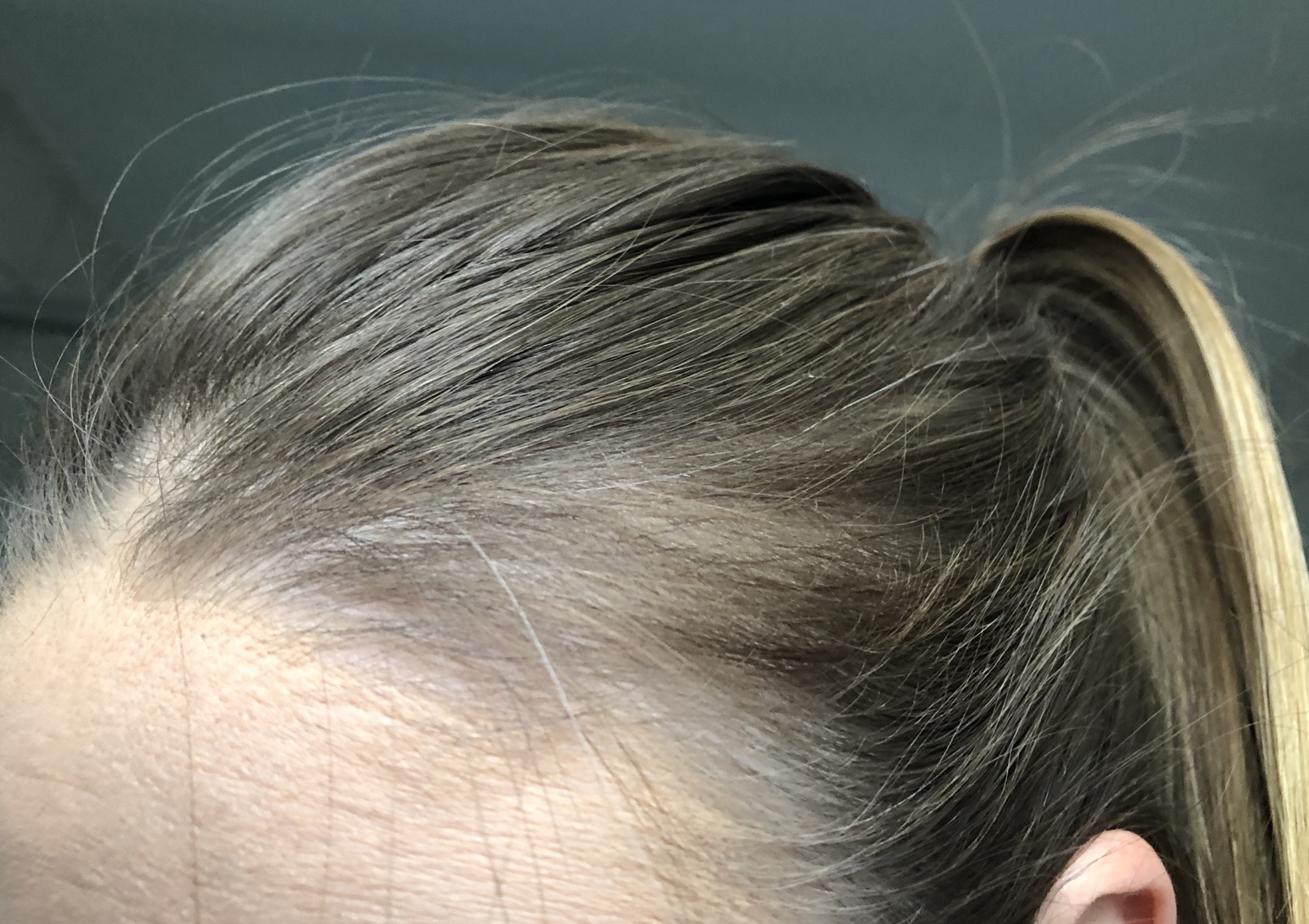 ich bekomme mit 26 graue haare was kann