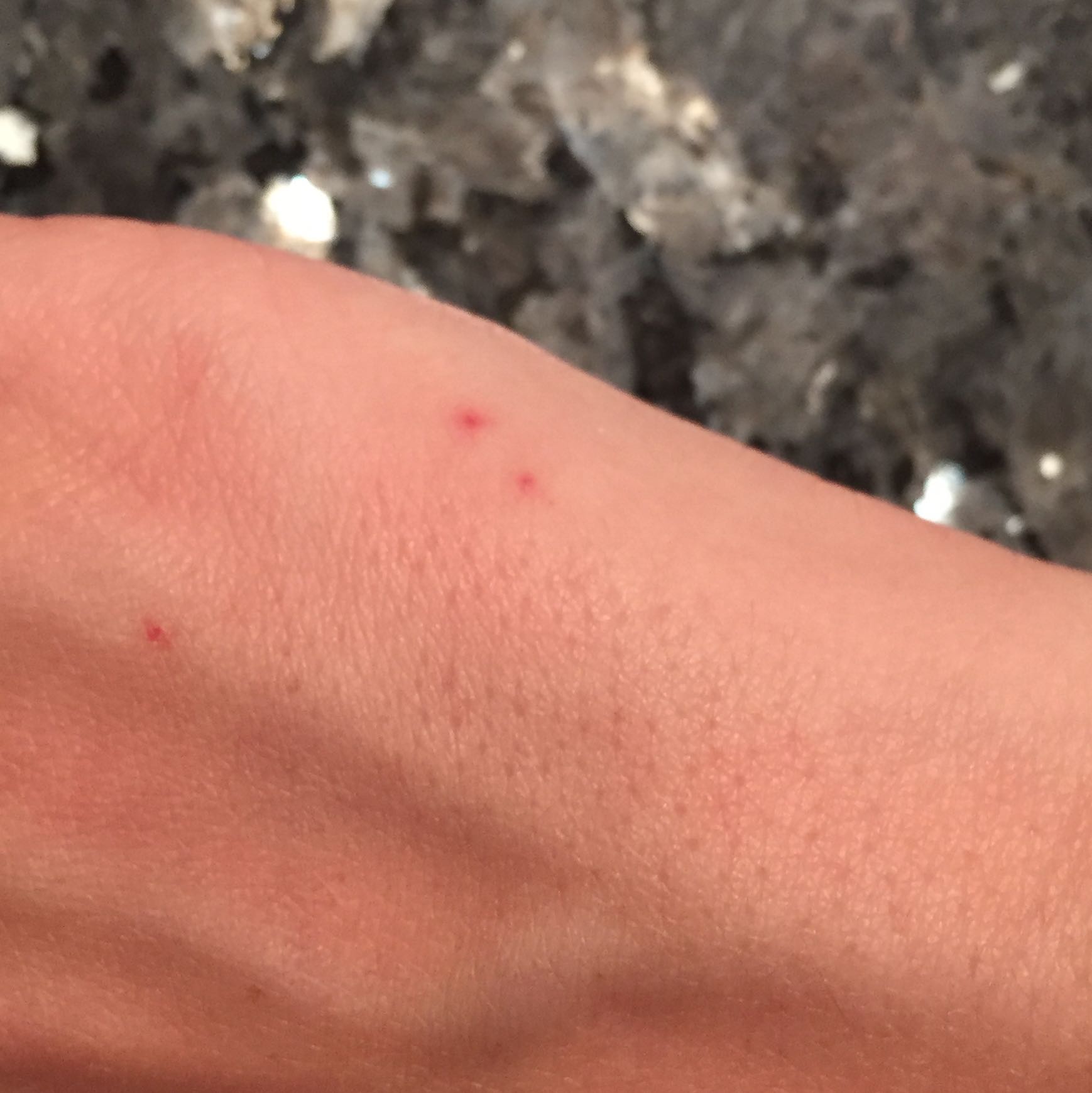 pickel haut pickel haut