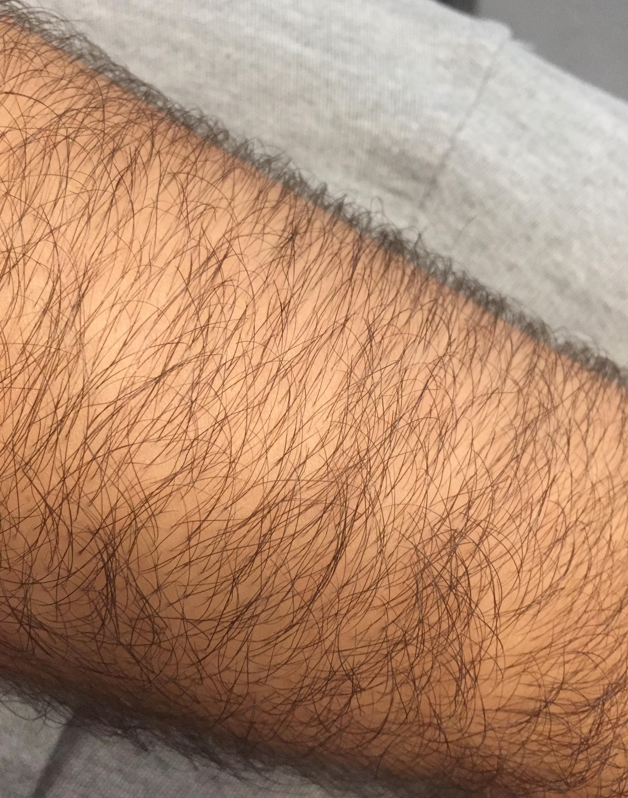 Ich Bin Mannlich 27 Soll Ich Mir Die Armhaare Abrasieren Mit Bild Sex Mode Style