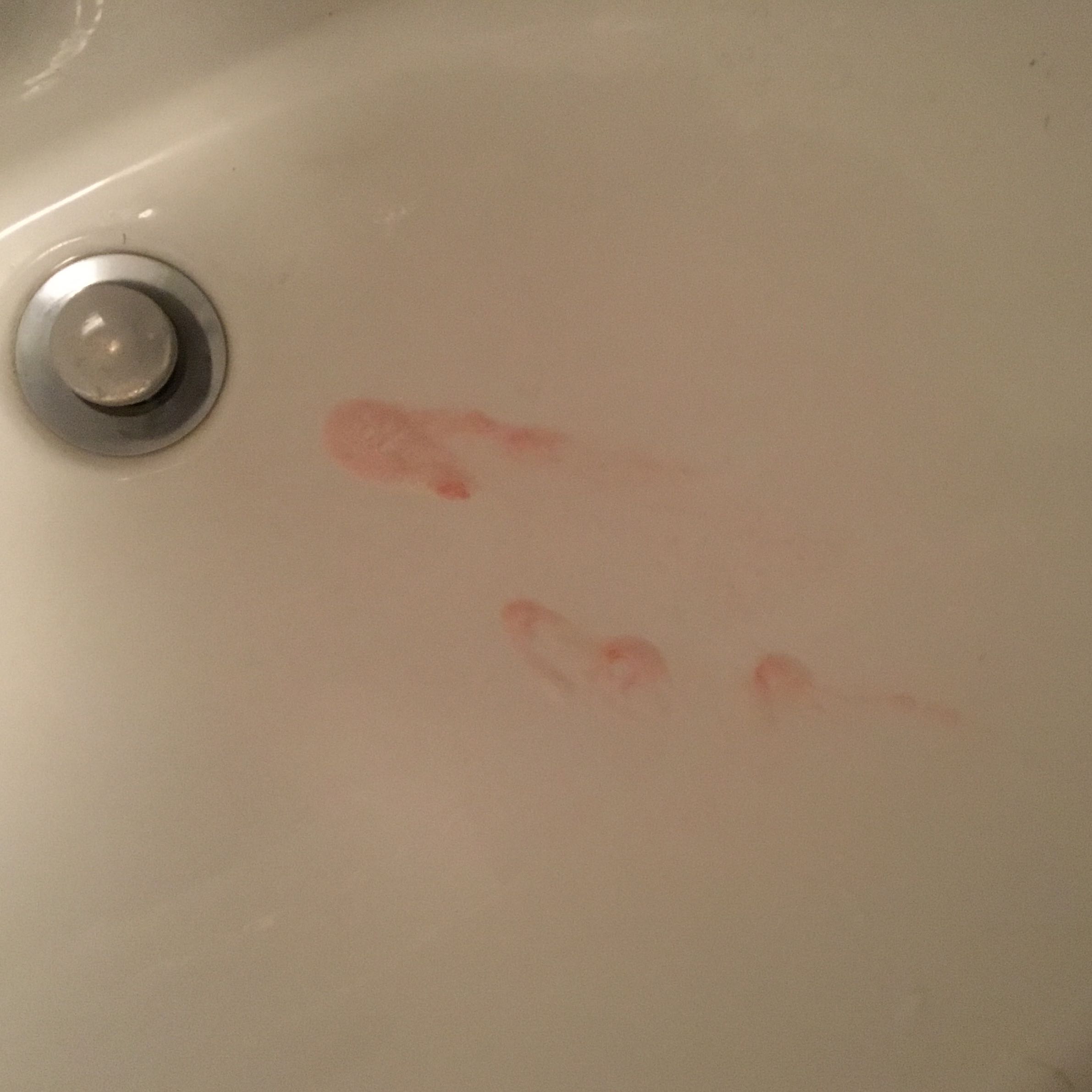 Ich Blute Aus Dem Mund Nach Dem Singen Wie Kann Das Sein Gesundheit Und Medizin Blut Hals Ich Blute Aus Dem Mund Nach Dem Singen Wie Kann Das Sein Gesundheit Und Medizin Blut Hals