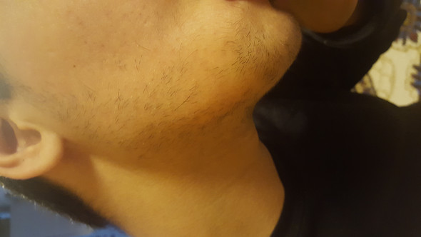 Ich Brauch Helfe Bart Mit 14 Rasieren Oder Wachsen Lassen 14 Jahre