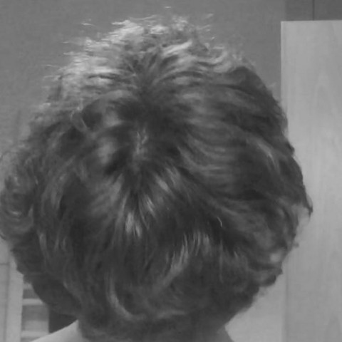 Ich Hab Eine Frage Ob Ich Schon Eine Kaale Stelle Habe Oben Oder Ob Es Der Wirbel Ist Habe Etwas Langere Haare Gesundheit Und Medizin Gesundheit Haarausfall