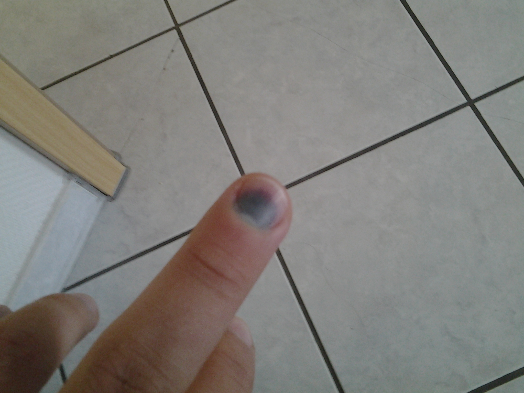 Ich hab meinen Fingernagel an der Tür eingeklemmt und jetzt hat er sich verfärbt und tut noch