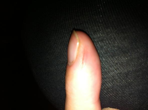 mein finger - (Verletzung, schneiden)