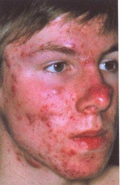 12+ Pickel Background