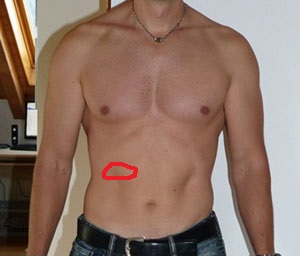 Ich habe ein zwicken in der mitte des bauches (Entzündung, Blinddarm)