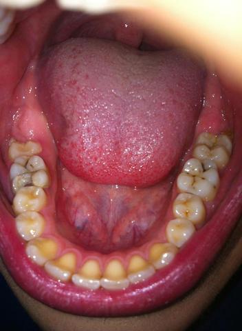 Meine Zähne :/ - (Zähne, Zahnarzt, Zahnmedizin)