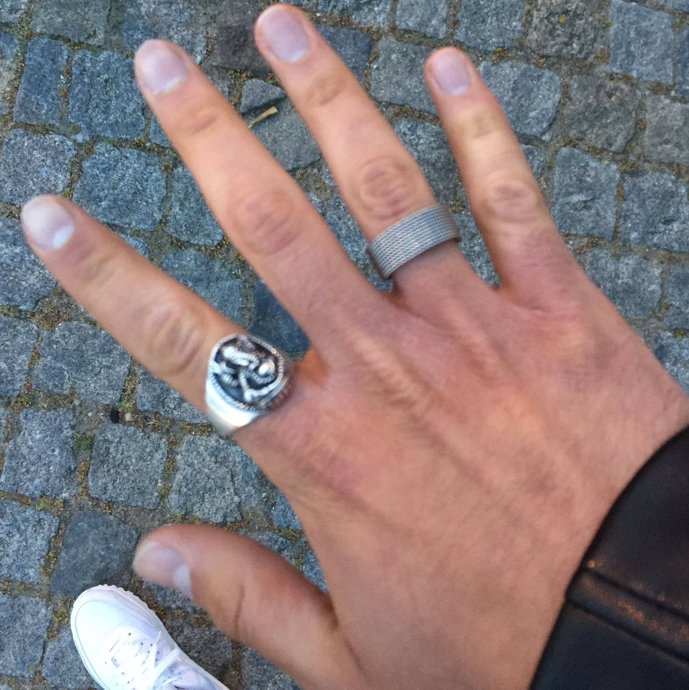 Ich Habe Eine Rote Hand Gelbe Fingergelenke Und Blaue Fingernagel Bild Gesundheit Sport Arbeit