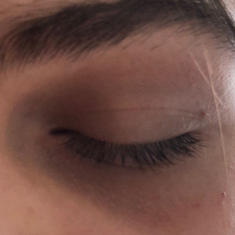 Ich Habe Jeden Tag Starke Augenringe Was Kann Ich Dagegen Tun Gesundheit Und Medizin Trocken Stark Ich Habe Jeden Tag Starke Augenringe Was Kann Ich Dagegen Tun Gesundheit Und Medizin Trocken Stark