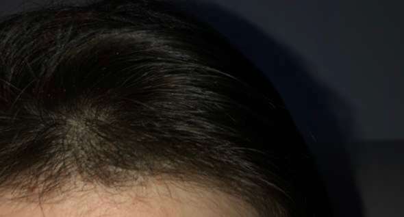 Ich Habe Meine Babyhaare Abgeschnitten So Sehen Sie Jetzt Aus Haare Haarwachstum Beschleunigen