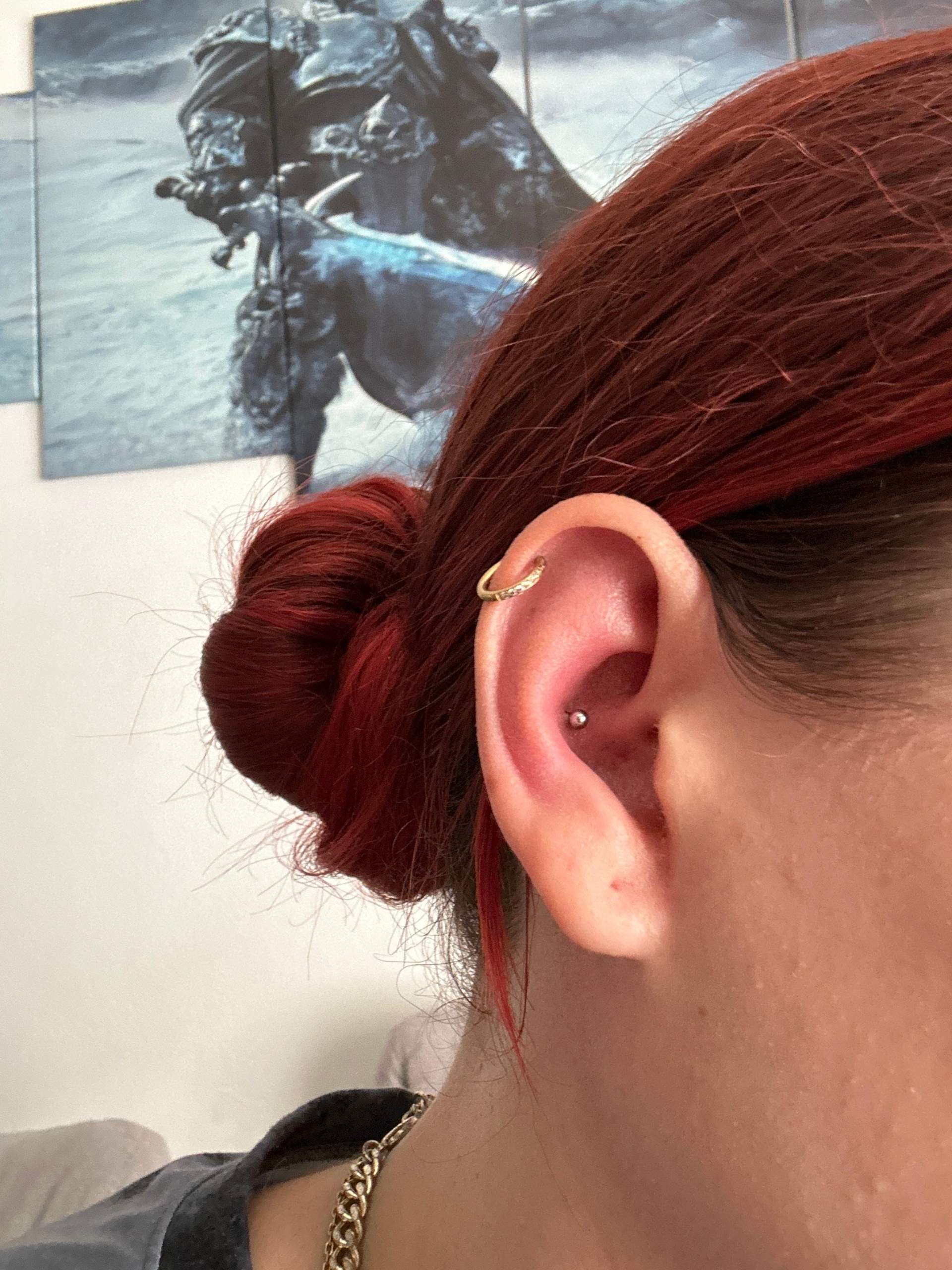 Ich habe mir Samstag ein Conch piercing stechen lassen und da war bis ...