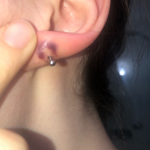 Ich Habe Mir Vor 3 en 5 Piercings Stechen Lassen 3 Ohrlocher 1 Helix Und Ein Sternum Alle Ausser Das Sternum Sind Blau Und Bluten Was Ist Da Los Gesundheit Und Medizin Piercing Tattoo