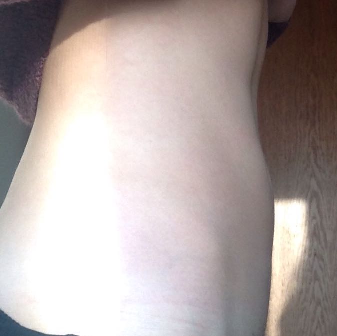 Ich Habe Ne Komische Wolbung Im Bauch Blahbauch