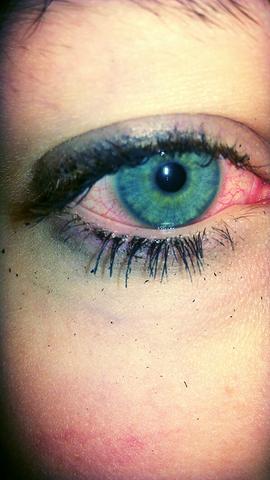 rote augen nach kiffen
