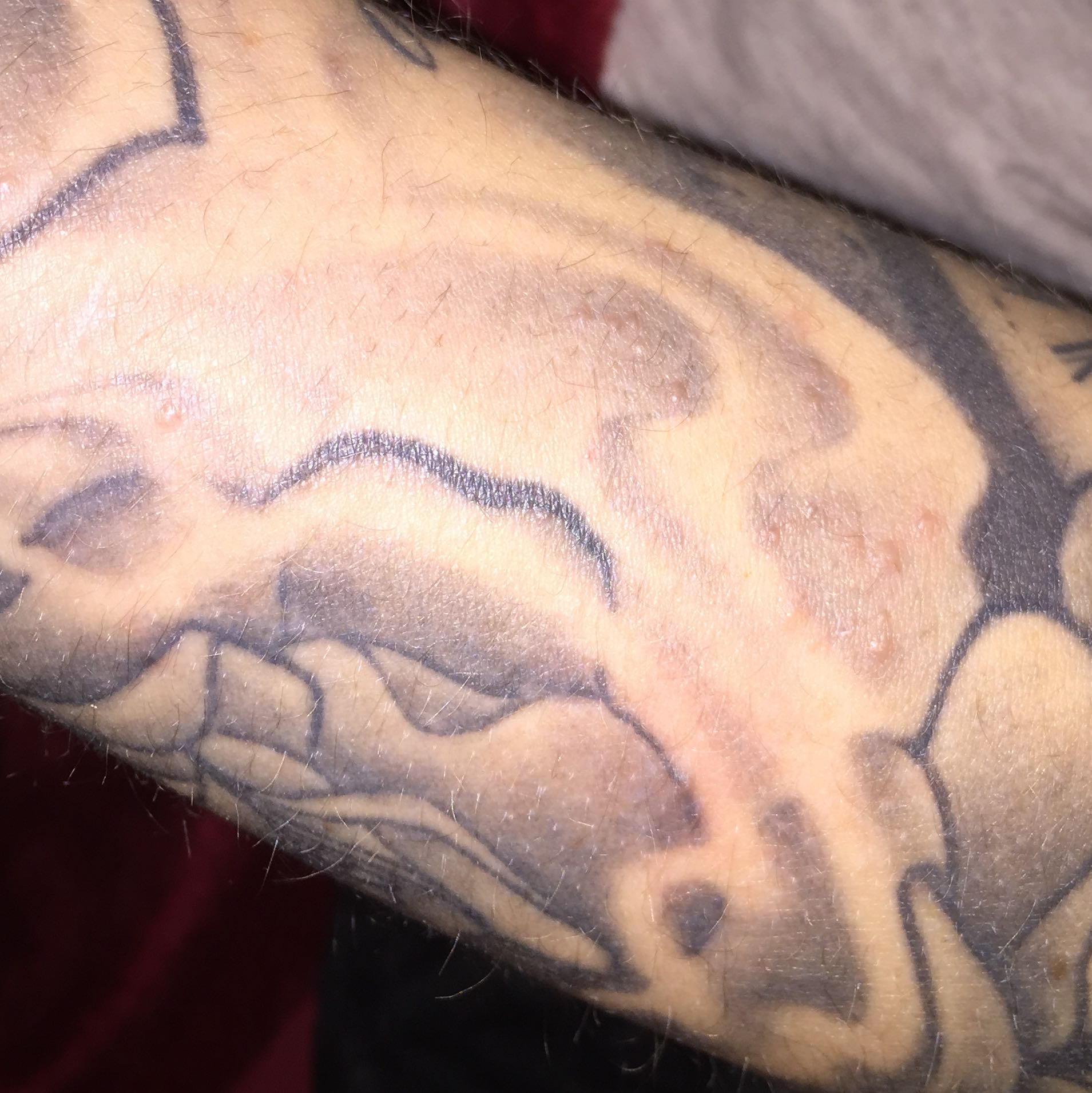 Ich habe seit paar wochen so punkte auf der hand (Ausschlag, Unterarm)