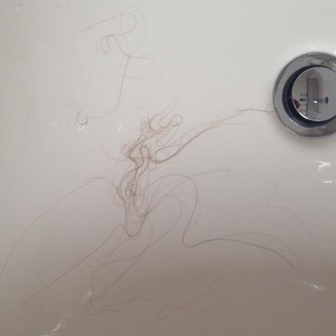 ich habe starken haarausfall mit 13