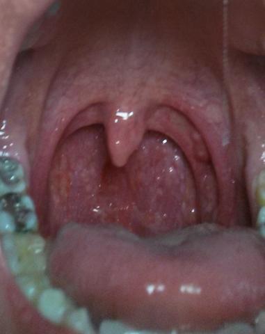 Mein Mund - (Geschlechtsverkehr, HIV, AIDS)
