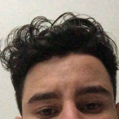 Ich Kann Meine Haare Nicht Nach Hinten Stylen Bzw Sterng Genommen Lecken Hasslich Wellen