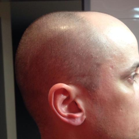 Ich Schame Mich Fur Meine Kopfform Foto Aussehen Kopf Stirn