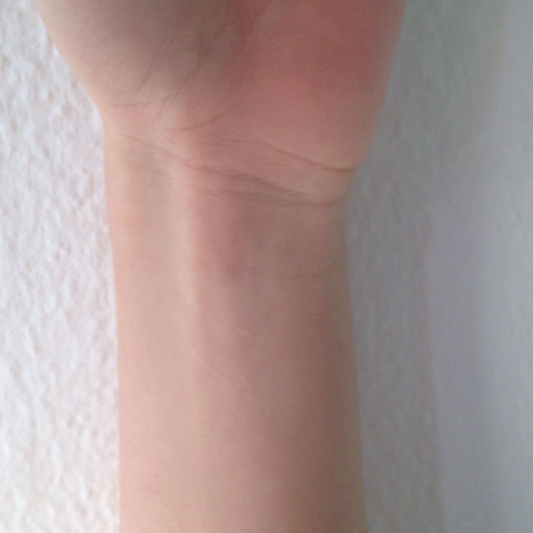 Normal? - (Hand, Arm, Pulsader)