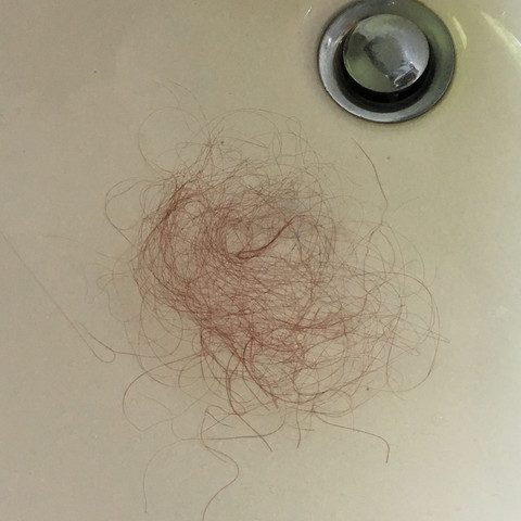 Das ist die Menge an Haaren die nach der Haarwäsche in der Bürste hängen bleiben - (Haarausfall, Haarverlust)