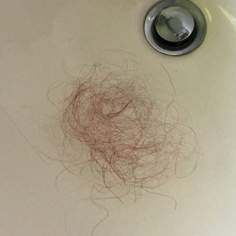 Ich Verliere In Letzter Zeit So Viele Haare Ist Das Normal Haarausfall Haarverlust Ich Verliere In Letzter Zeit So Viele Haare Ist Das Normal Haarausfall Haarverlust
