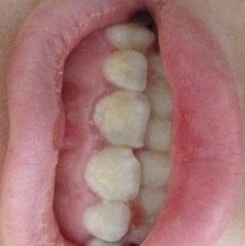Zähne - (Gesundheit, Zähne, Pflege)
