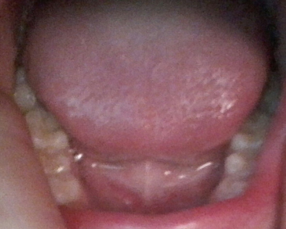 Meine zähne - (Angst, Zahnarzt)