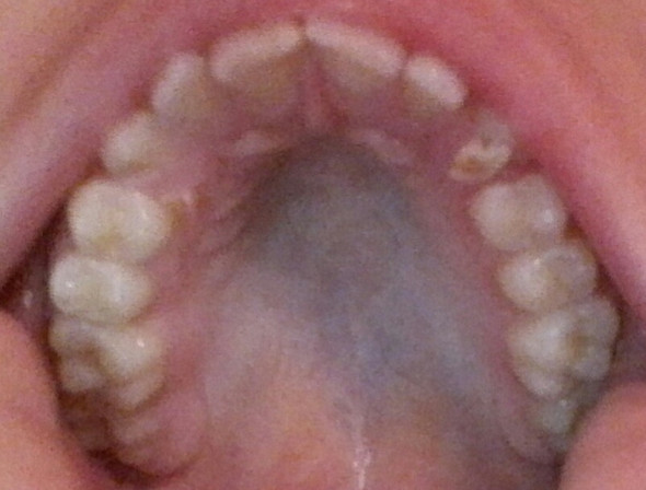 Meine Zähne - (Angst, Zahnarzt)