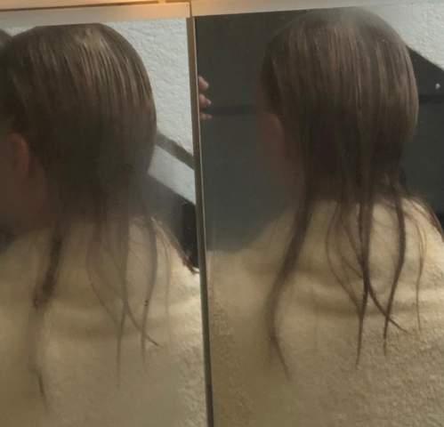 immer weniger haare jetzt gar keine