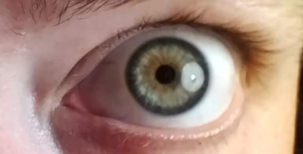 Bild zum Beitrag