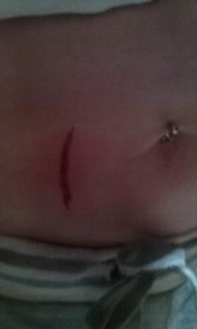 So siehts dann aus -.- - (Freizeit, Gefallen, glasscheibe)