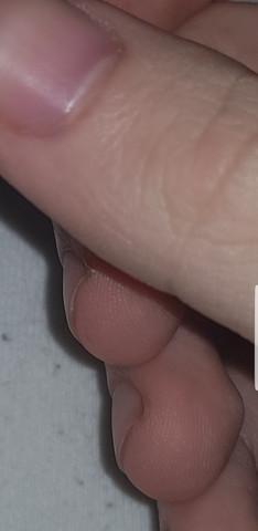 - (Mathematik, Hand, Nägel)